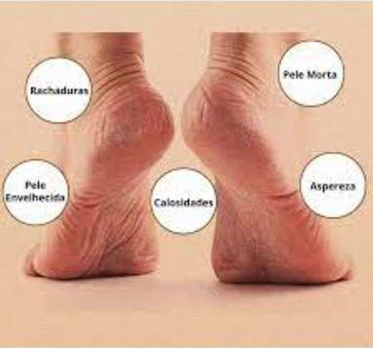 Piedi Perfetti, Pés Perfeitos, Pés, Lixa Pés