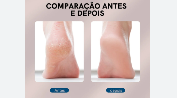 Piedi Perfetti, Pés Perfeitos, Pés, Lixa Pés