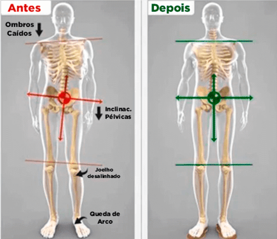 Star Plus Orthopedic